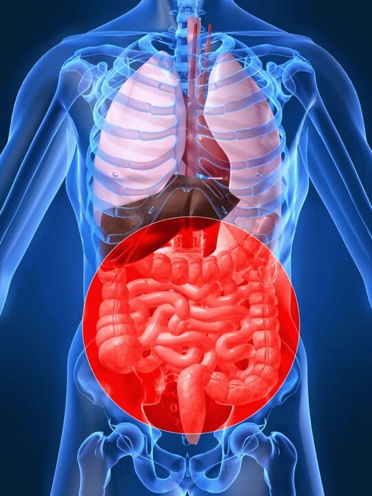 A disbiose intestinal leva á activación do virus do papiloma humano